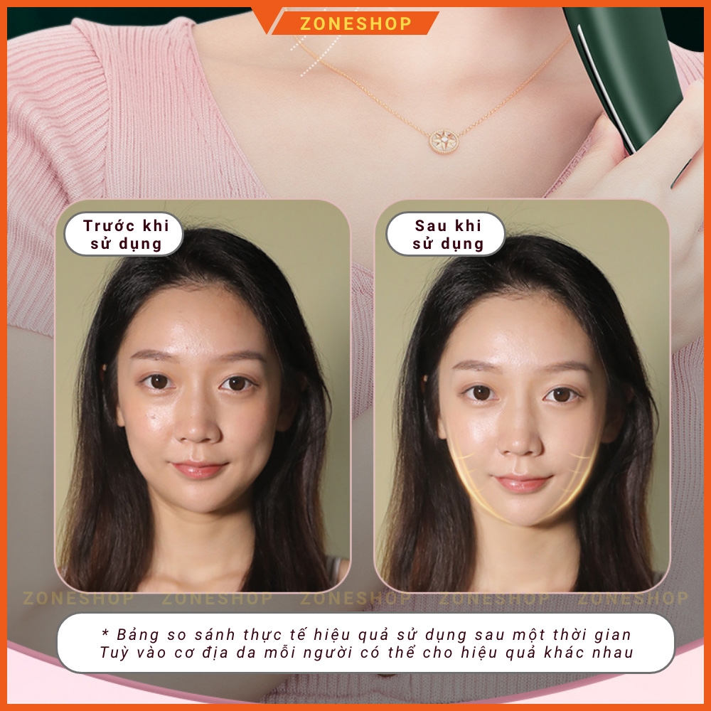Máy massage mặt cầm tay ION 4 chế độ, 2 nguồn ánh sáng, chăm sóc da mặt ion light, sóng âm - SP Chính hãng [ZONESHOP]